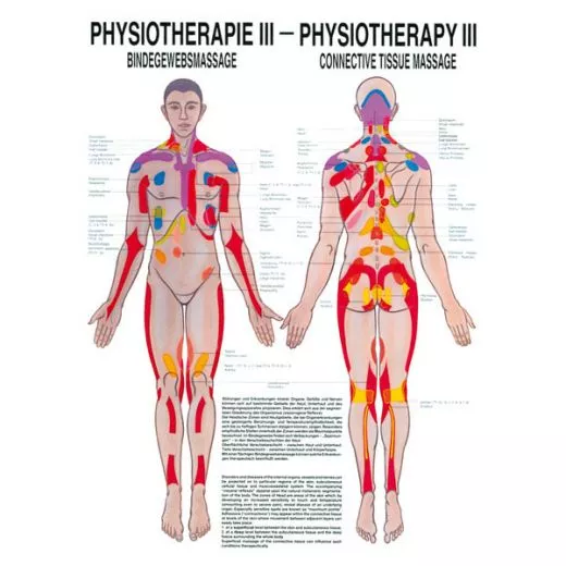 LEHRTAFEL 50 x 70 CM Physiotherapie III, LAMINIERT (BINDEGEWEBSMASSAGE)