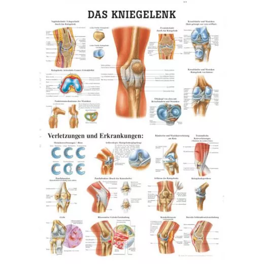 LEHRTAFEL 70 x 100 CM Das Kniegelenk (Laminiert)