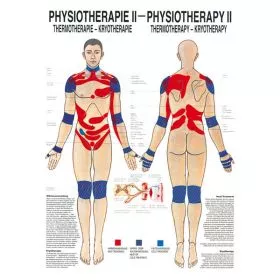 LEHRTAFEL 50 x 70 CM Physiotherapie II, LAMINIERT (THERMOTHERAPIE - KRYOTHERAPIE)
