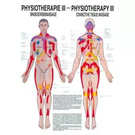 LEHRTAFEL 50 x 70 CM Physiotherapie III, LAMINIERT (BINDEGEWEBSMASSAGE)