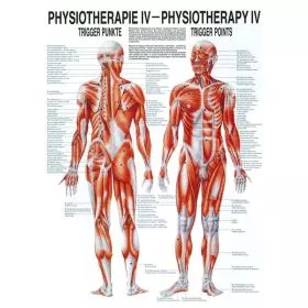 LEHRTAFEL 50 x 70 CM Physiotherapie IV, LAMINIERT (TRIGGER PUNKTE)