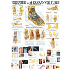 LEHRTAFEL 70 x 100 CM GESUNDE & ERKRANKTE FSSE (LAMINIERT)